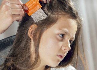 13 Amazing Facts About Where Does Head Lice Come From! Where Does Lice Come From