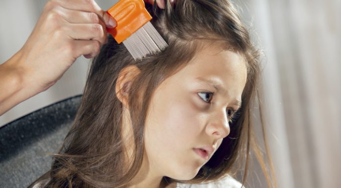 13 Amazing Facts About Where Does Head Lice Come From! Where Does Lice Come From