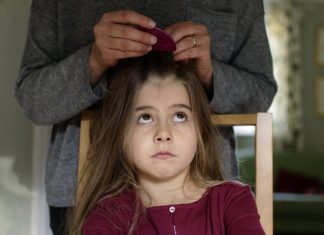 Lice Eggs vs Dandruff? A Complete Guide To Remove Lice Eggs lice eggs vs dandruff