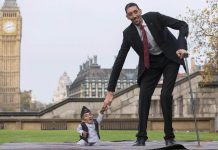 Gigantism Definition