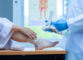 How Physio After a Broken Ankle Can Help You to Recover? physio after a broken ankle